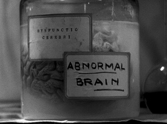 Abnormal Brain | 2.5" sticker